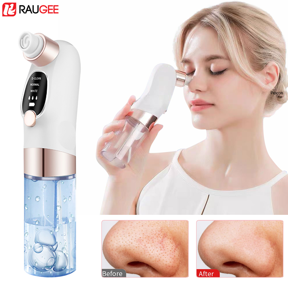 Mee-eter verwijderaar Elektris - Air Bubble Remover recensie en prijs